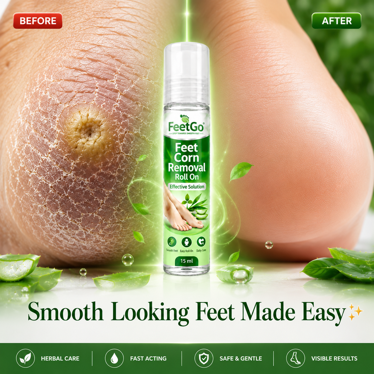 FeetGo Corn Removal Roll-On