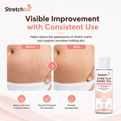 Stretchgo  Stretchmark Removal Herbal Oil