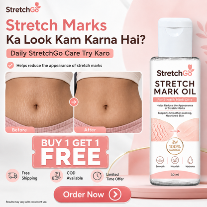 Stretchgo  Stretchmark Removal Herbal Oil