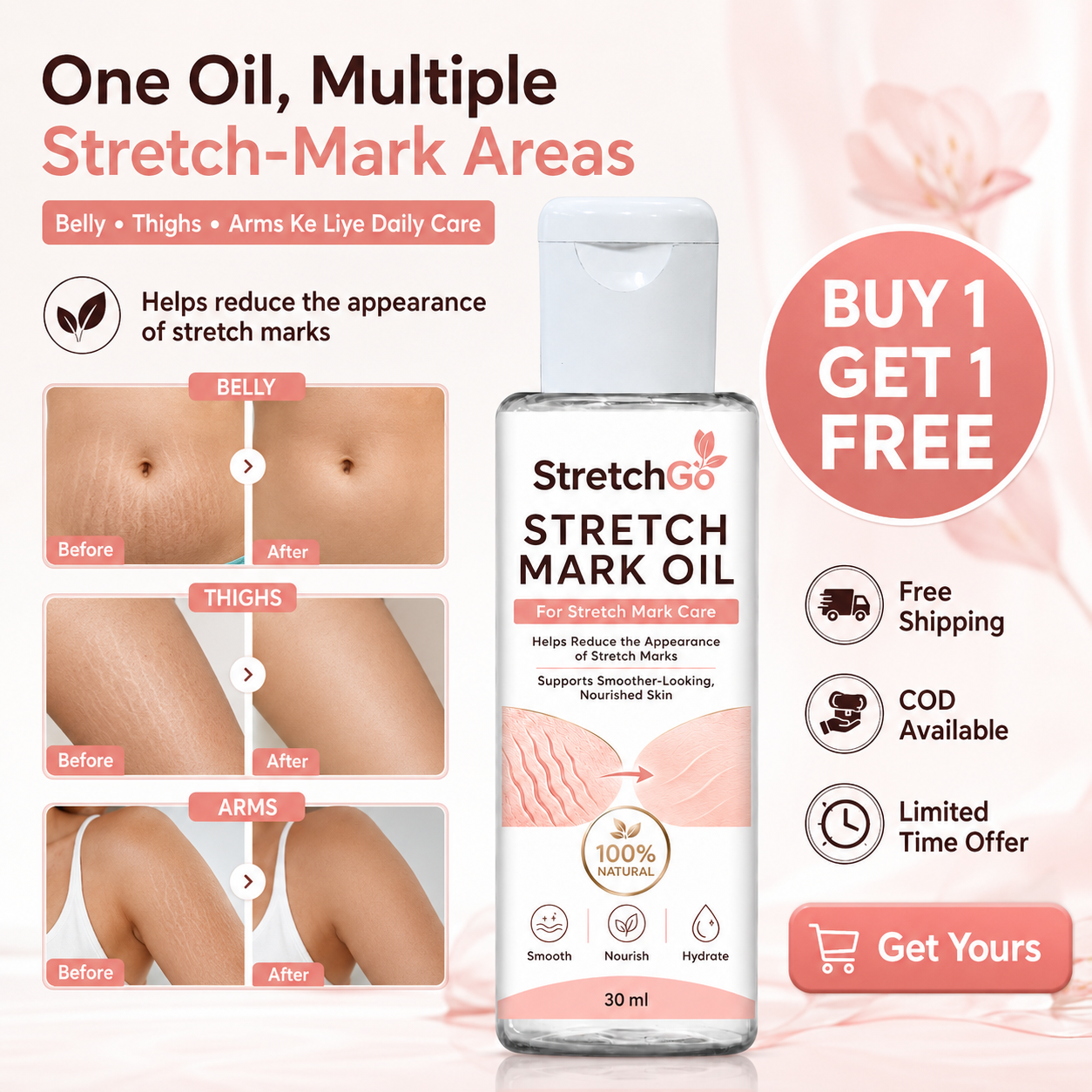 Stretchgo  Stretchmark Removal Herbal Oil
