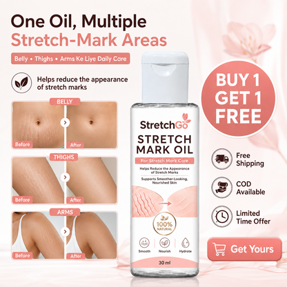 Stretchgo  Stretchmark Removal Herbal Oil