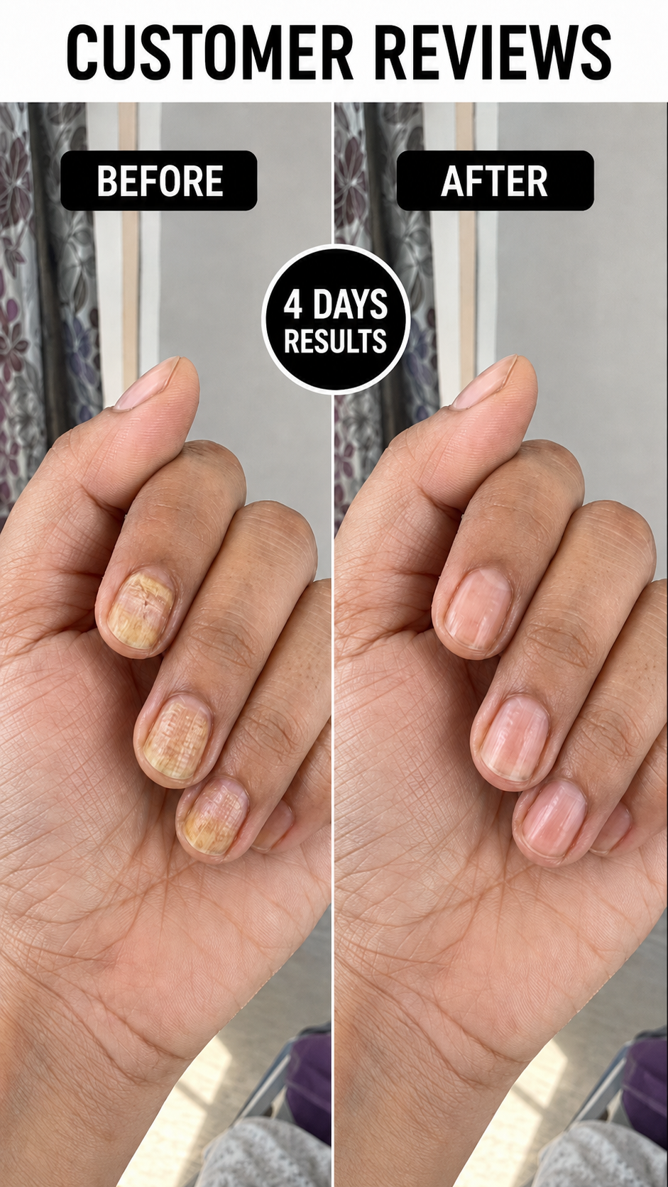 Anti Paronychia Relief Nail Oil - Buy 1 Get 1 FREE🔥