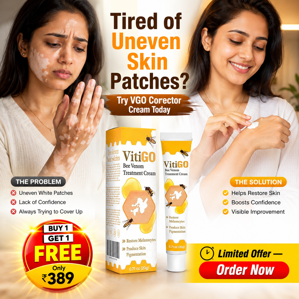 VitiGO Corrector Cream - BUY 1 GET 1 FREE 🔥