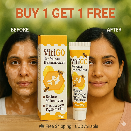VGO Corrector Cream - BUY 1 GET 1 FREE 🔥