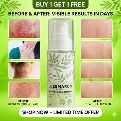 ORIGINAL Eczemaron Anti-Fungal Spray-🔥 BUY 1 GET 1 FREE 🔥