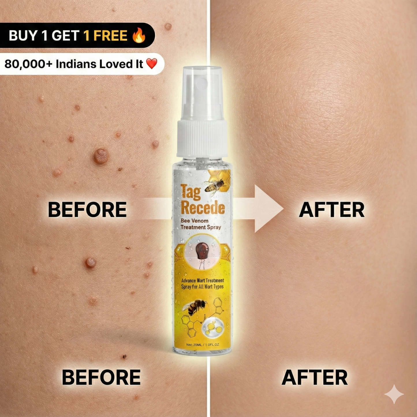 Wart & Skin Tag Remover Spray - 🔥 BUY 1 GET 1 FREE