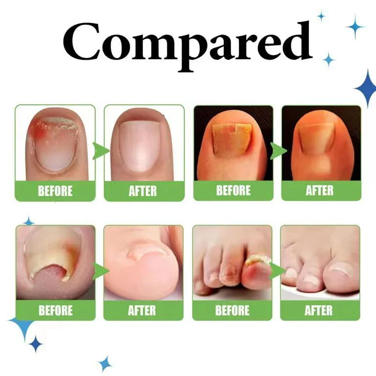 Rubriel Nail Repair Oil - (Buy 1 Get 1 FREE🔥🔥)