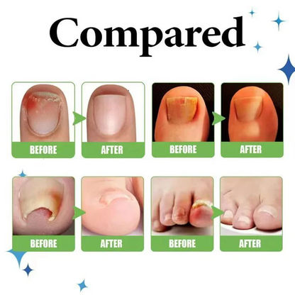 Rubriel Nail Repair Oil - (Buy 1 Get 1 FREE🔥🔥)
