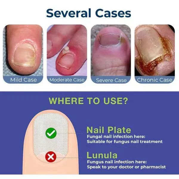 Rubriel Nail Repair Oil - (Buy 1 Get 1 FREE🔥🔥)