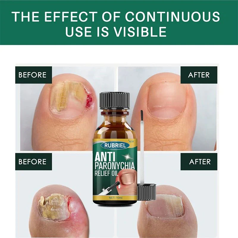 Rubriel Nail Repair Oil - (Buy 1 Get 1 FREE🔥🔥)