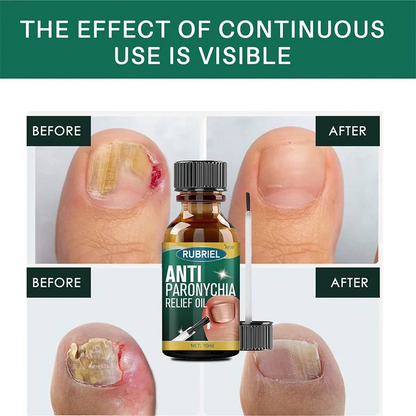 Rubriel Nail Repair Oil - (Buy 1 Get 1 FREE🔥🔥)