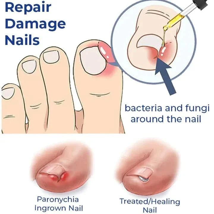 Rubriel Nail Repair Oil - (Buy 1 Get 1 FREE🔥🔥)
