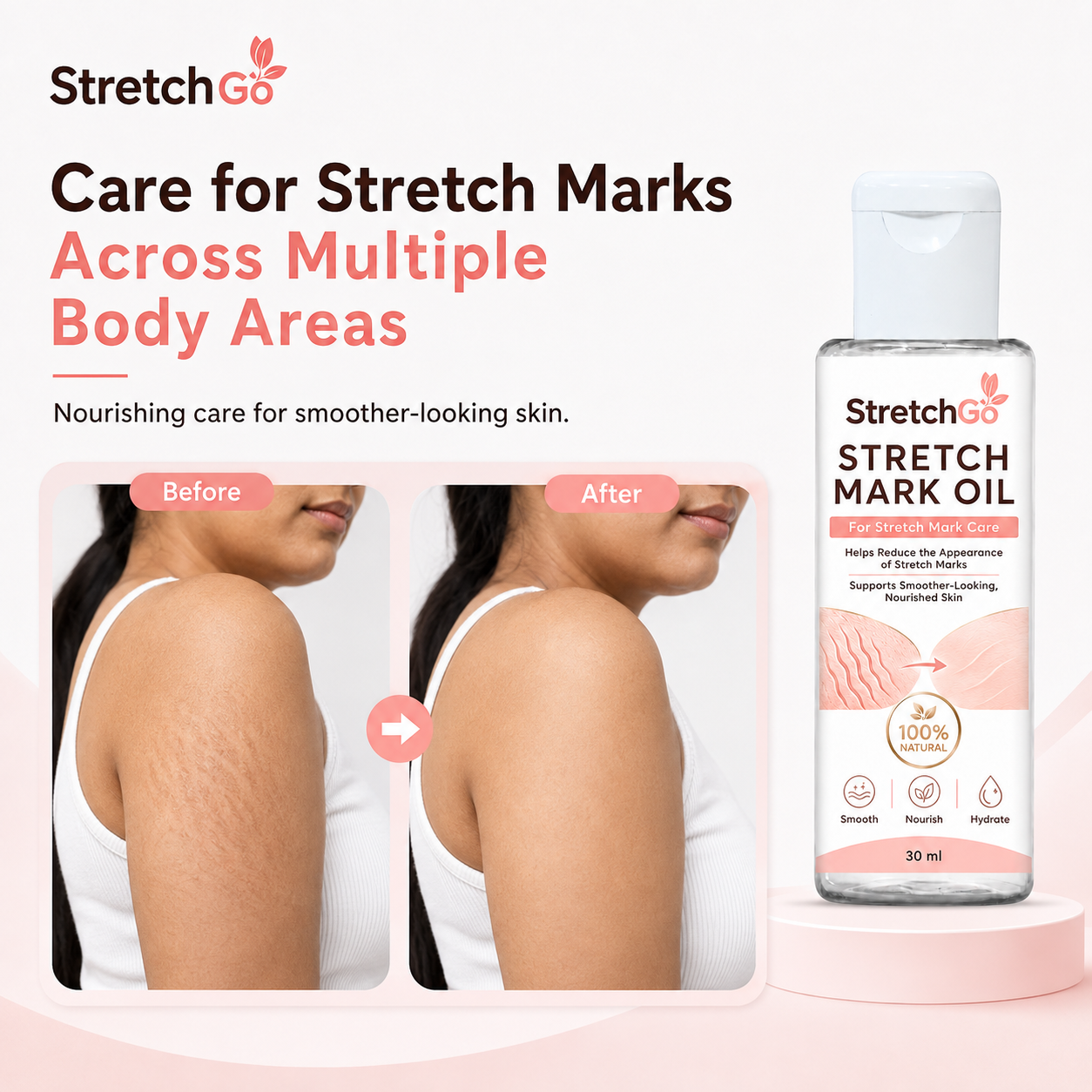Stretchgo  Stretchmark Removal Herbal Oil