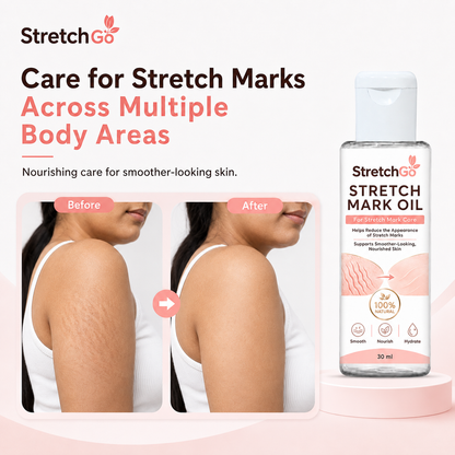 Stretchgo  Stretchmark Removal Herbal Oil